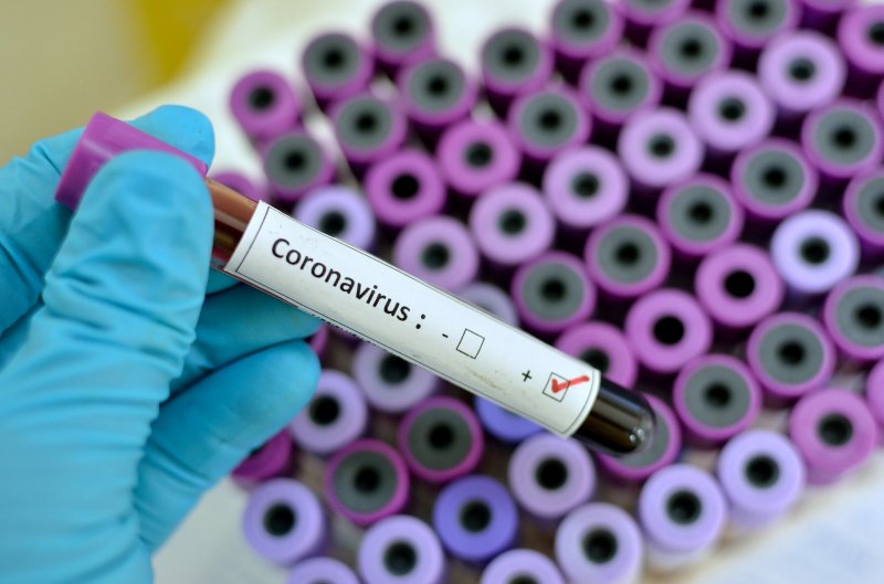 И еще 261 северянин заболел CoViD-19 за сутки И еще 261 северянин заболел CoViD-19 за сутки