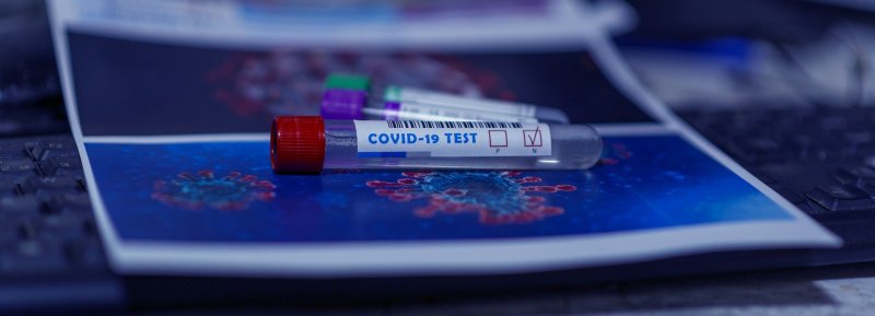 Число зараженных CoViD-19 в Заполярье растет: +311 случаев