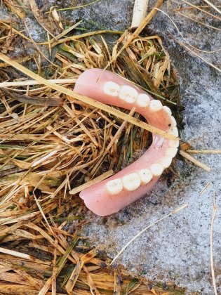 Потерял зубы на улице неизвестный в Североморске