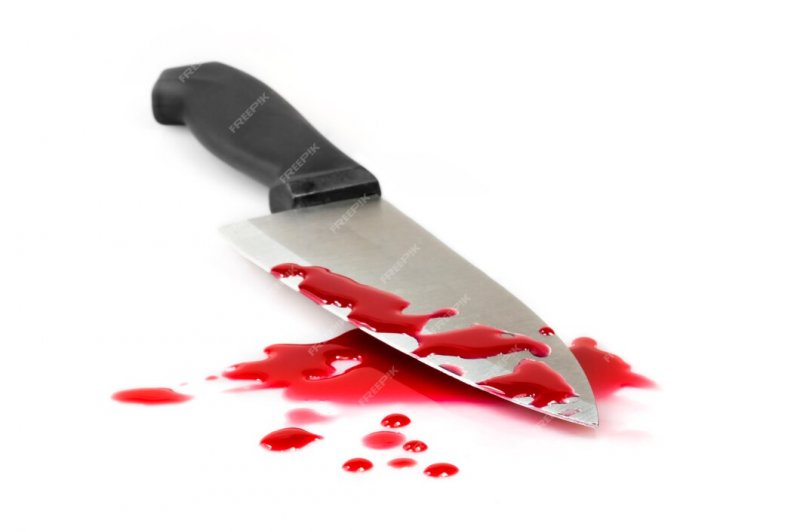 Кровавые разборки в коммуналке: сосед пырнул ножом соседа в Мурманске