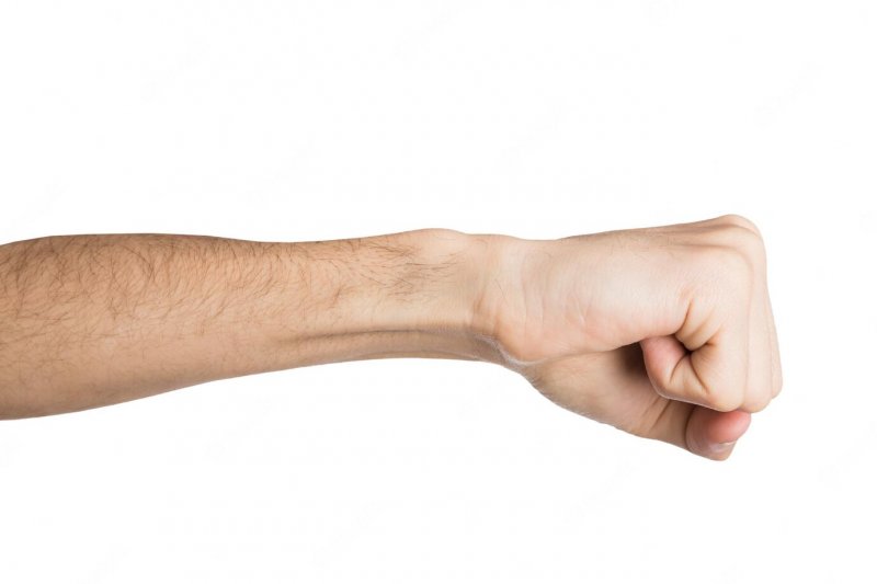 Массовая драка в Ковдоре: возбуждено уголовное дело