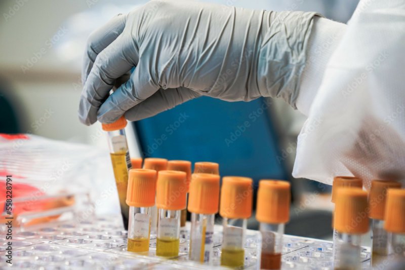 Виновника смертельной аварии проверяют на наркотики и алкоголь в Мурманске