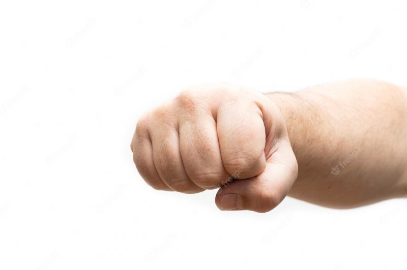 От злости парень избил трех незнакомок на улице в Мончегорске