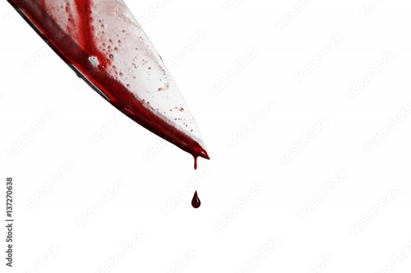 В Оленегорске женщина выжила после тяжелых ран: нападавшему грозит 11 лет тюрьмы