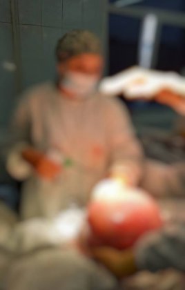 Опухоль весом 18 кг удалили у пациентки в Мурманске