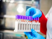 И снова 198 заразившихся «короной» в Мурманской области