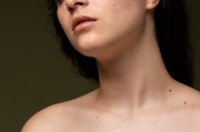 <p><img src="https://novosti-murmanskoy-oblasti.ru/uploads/posts/2024-09/1726809968_side-view-woman-skin-texture-with-moles_23-2149457568.jpg" alt="" /></p>

<p><em>Прыщи лечат различными косметологическими способами</em></p>

<p>По-научному прыщи называются комедоны. Эти небольшие кисты образуются из-за закупорки устья волосяных фолликулов под кожей. Чаще всего прыщи поражают так называемую Т-зону на лице, она охватывает часть лба и нос. Именно там расположено наибольшее количество сальных желез. Но они могут появляться и на других частях тела &mdash; зачастую это грудь и спина.</p>
<p><br />Причин отчего появляются прыщи много, среди самых частых &mdash; жирная кожа, долгое пребывание на жаре, умывание горячей водой, неправильная косметика, хронический стресс, гормональные нарушения.</p>
<p><br />В современных условиях при лечении прыщей чаще всего прибегают к услугам косметологов. Один из способов &mdash; механическая чистка. Она заключается в том, что в зоне прыщей делают небольшие проколы иглой Видаля и удаляет скопившуюся в комедоне массу. А после кожу обрабатывают антисептическим средством и наносят противовоспалительную маску.</p>

<p>Еще один популярный метод &mdash; аппаратная чистка. Проблемную кожу лечат с помощью лазерного пилинга. В отличии от механической чистки эта процедура проходит быстрее. Но важно помнить, что после воздействия лазером кожа может восстанавливаться дольше, чем после механической чистки.</p>

<p>Чаще всего на коже появляются прыщи. Но есть ряд других высыпаний, которые можно спутать с прыщами &mdash; милиумы (белые угри), сирингома (доброкачественное новообразование в потовой железе), контагиозный моллюск (вирусная инфекция), плоские бородавки. У каждой из проблем свои причины возниквновения и методы лечения. Лучше всего на эти темы прокунсультируют врачи-дерматологи или специалисты-косметологи.</p>

<p><em>Айгуль Булатова</em></p>
<p><em>Фото: Freepik</em></p>

