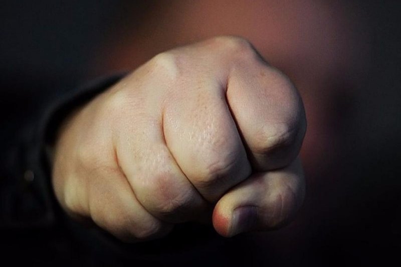 Изуродовал кулаком лицо жене за посиделку с подругой в Мурманске