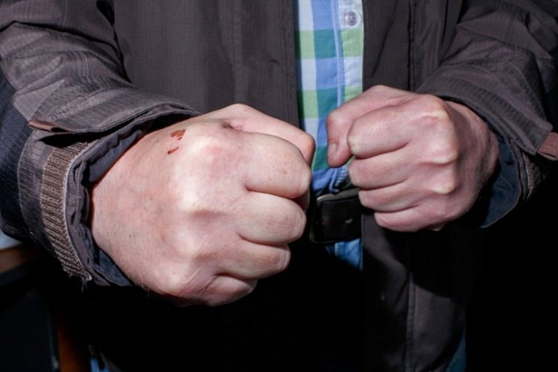 Сломал челюсть прохожему житель Гаджиево