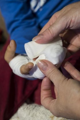Отдавило пальцы мужчине в руднике в Печенгском округе